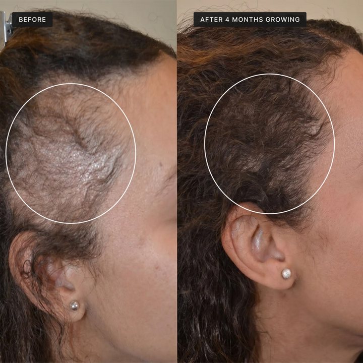 Before and after 4 months