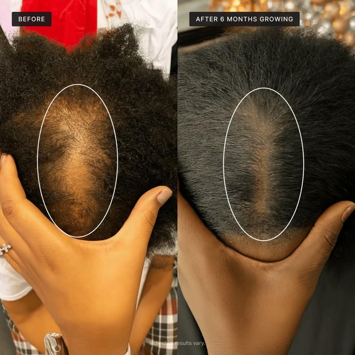 Before and after 6 months