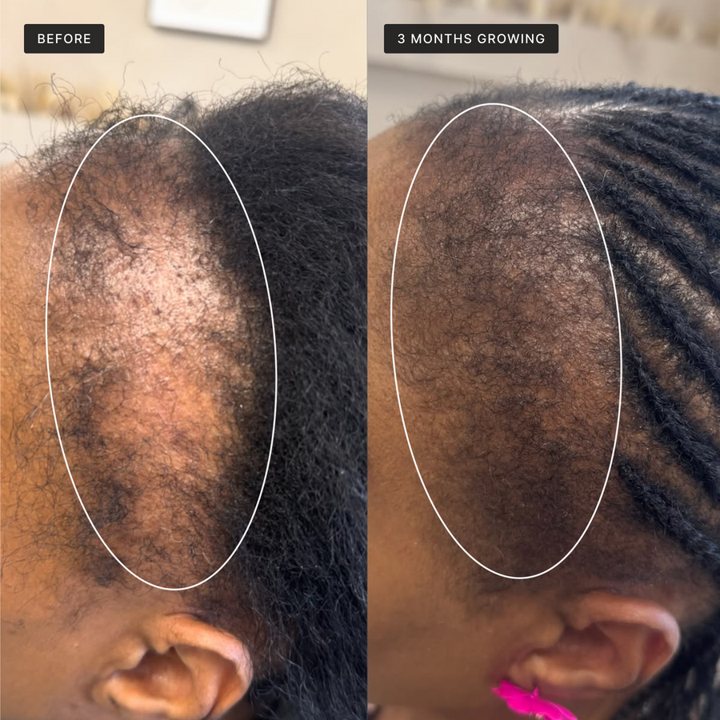 Before and after 3 months